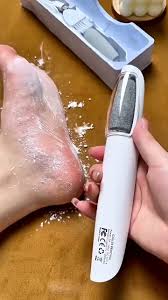 Electric Rechargeable Foot Filer – Callus Remover for Smooth, Soft Feet