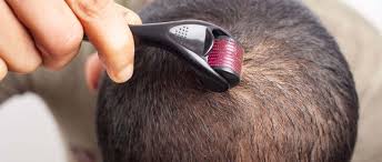 Derma Roller for Face & Skin | Microneedling Tool for Wrinkles, Scars, & Hair Growth